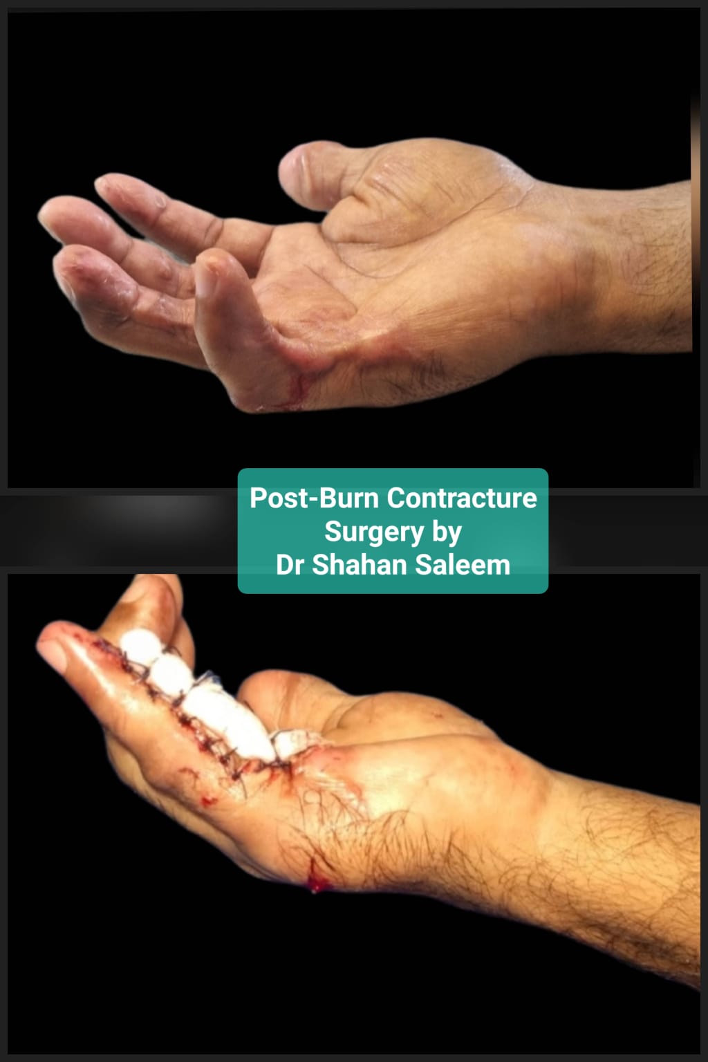 Before & After 31